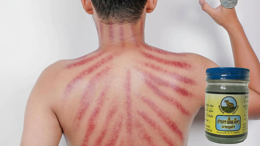 Scraping the Wind Coining Gua Sha Massage Therapy in Laos